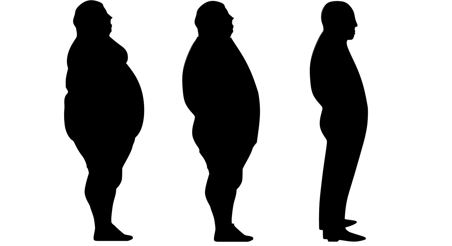 Лучшая поза толстым. Ожирение. Патологическое ожирение. Ожирение иллюстрация.
